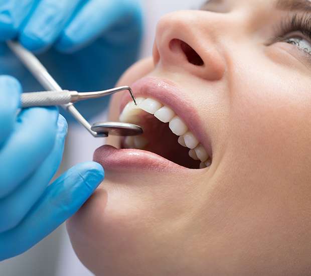 Los Alamitos Dental Bonding