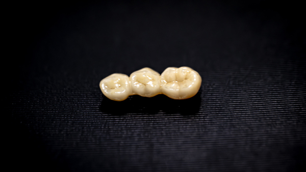 Why Dental Bridges Are An Effective Tooth Restoration