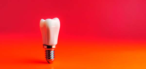 Benefits Of Dental Implants