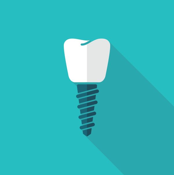 dental implants Los Alamitos, CA