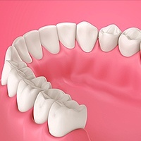 Gum Disease Los Alamitos, CA