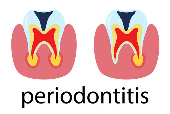 How Periodontic Treatment Can Make Your Daily Dental Routine Easier