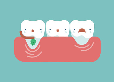 Periodontics Can Save Your Smile By Restoring Your Gums
